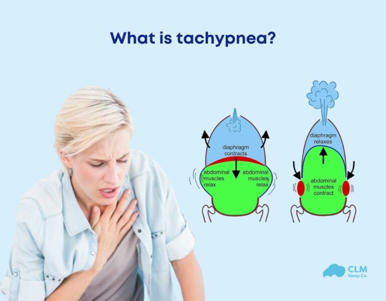 Tachypnea: Symptoms, Causes and Treatment – CLM Sleep Co.